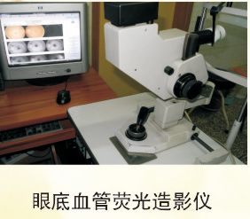 眼底血管荧光造影仪