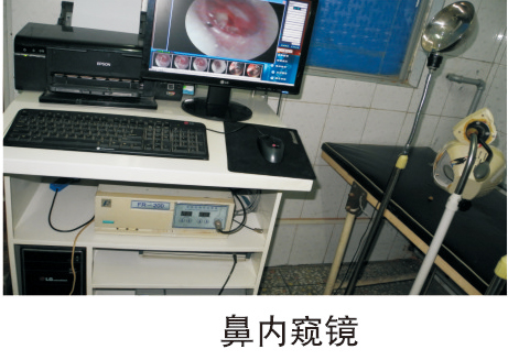 鼻内窥镜