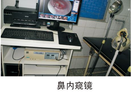 鼻内窥镜